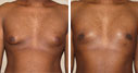 Before & After Photos